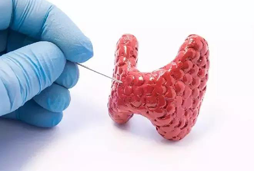 甲状腺疾病，包括甲状腺功能减退和甲状腺功能亢进，自古以来就是反复被医学研究人员研究的疾病